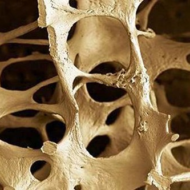 Õõvastav statistika ütleb, et Eestis on luude hõrenemine ehk osteoporoos kolmandikul (!) üle 65-aastastest ja pooltel (!) üle 70-aastastest naistest.Elu jooksul saab osteoporootilise luumurru iga teine naine(!)Niisiis, kui mitte sina, siis sinu õde.Kui mitte sina, siis sinu naabrinaine või töökaaslane:( Nii nagu dementsus ei teki üleöö, vaid sellele luuakse eeldused juba keskeas, nii pannakse ka [&hellip;]